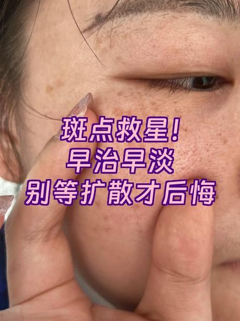 后置摄像头拍照有斑图标