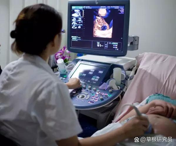 四维彩超图片怎么转换成照片缩略图