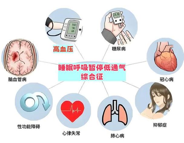 睡眠呼吸暂停症是什么原因引起的缩略图
