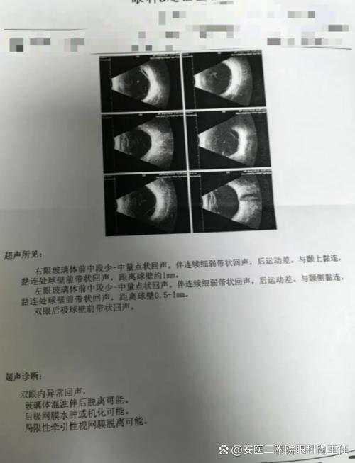 监控画面一闪一闪的原因是什么缩略图