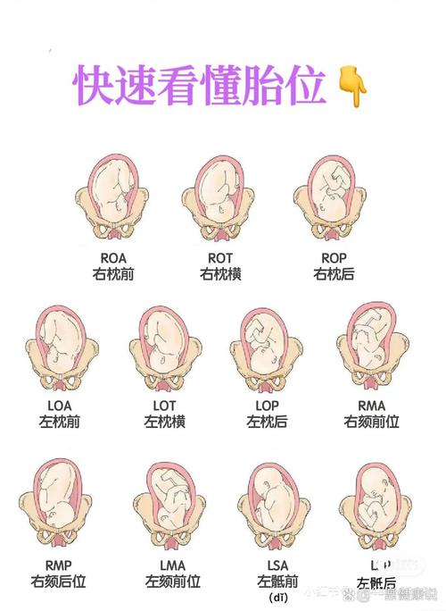胎儿横位是什么原因造成的缩略图