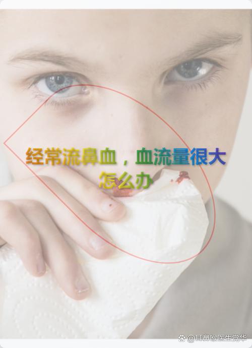 鼻窦炎流鼻血频繁怎么办缩略图