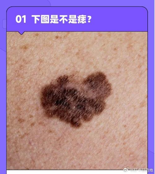 照片黑点是什么意思啊缩略图