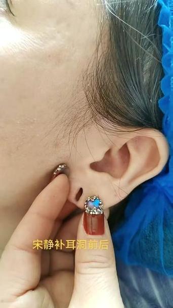 带耳机会使耳洞变大吗图标