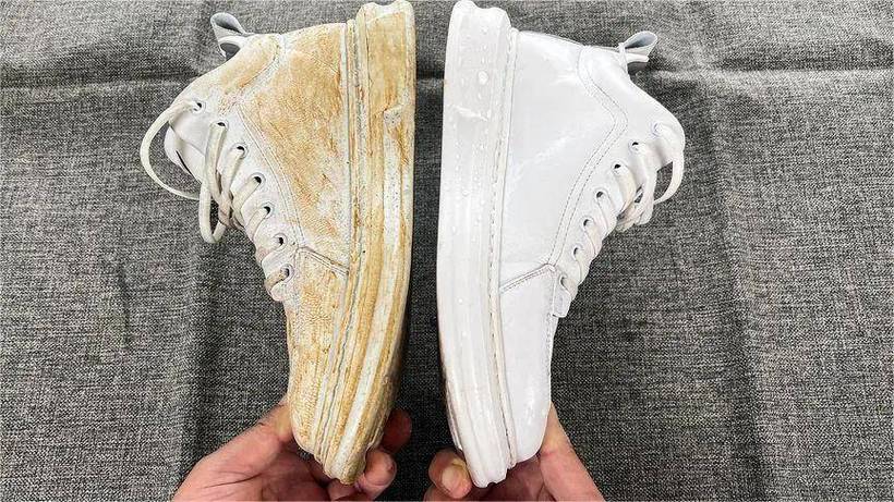 小白鞋皮面发黄怎么洗白妙招缩略图