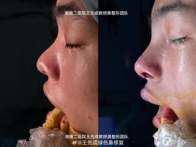 ps图片畸形矫正游戏截图