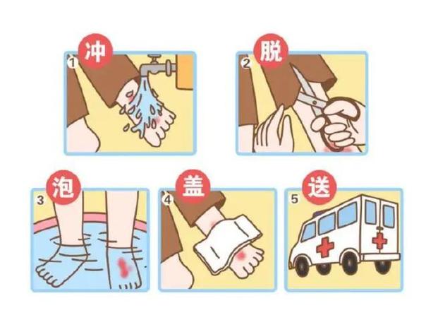 烫伤外露好得快还是包扎缩略图