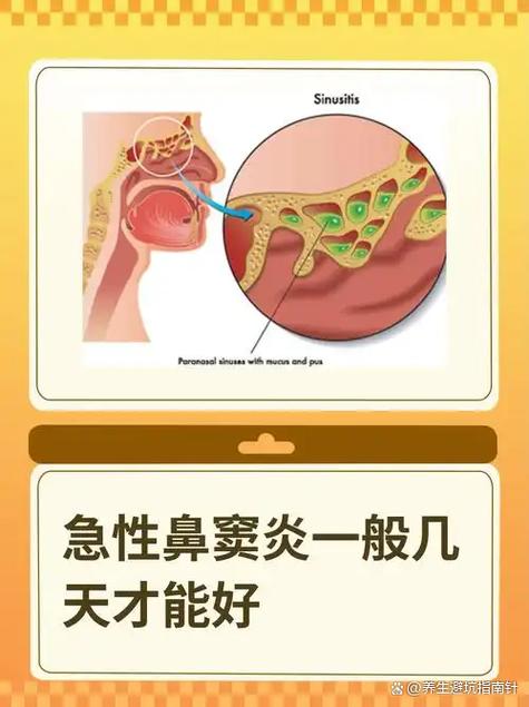 鼻炎和鼻窦炎图片缩略图