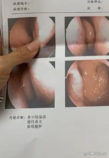 鼻窦炎会流鼻血吗游戏截图