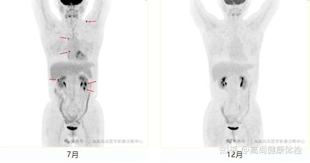 xthz路pet的特点图标