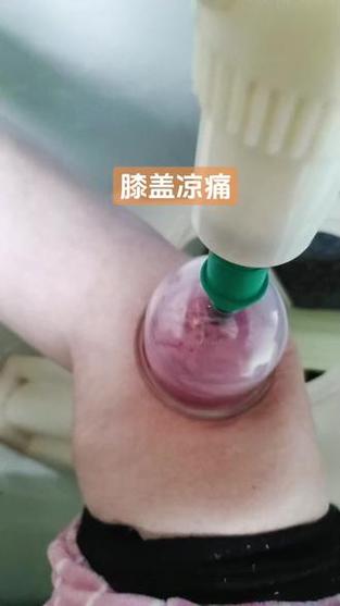 真空拔罐器使用方法视频教程图标