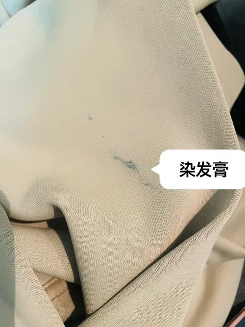染发剂弄到衣服上时间久了怎么办缩略图
