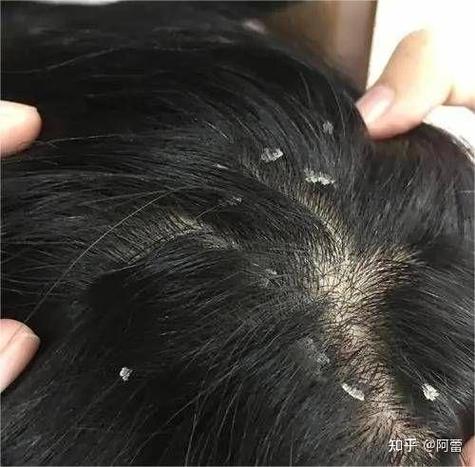 女生发皮一下什么意思缩略图