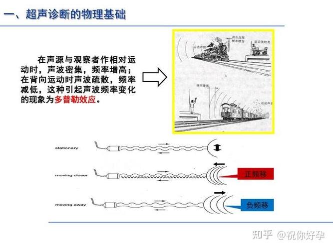 四维彩超成像不清晰什么原因缩略图