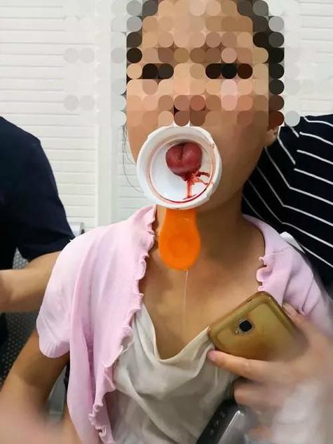 嘴吸瓶子变紫几天能好游戏截图