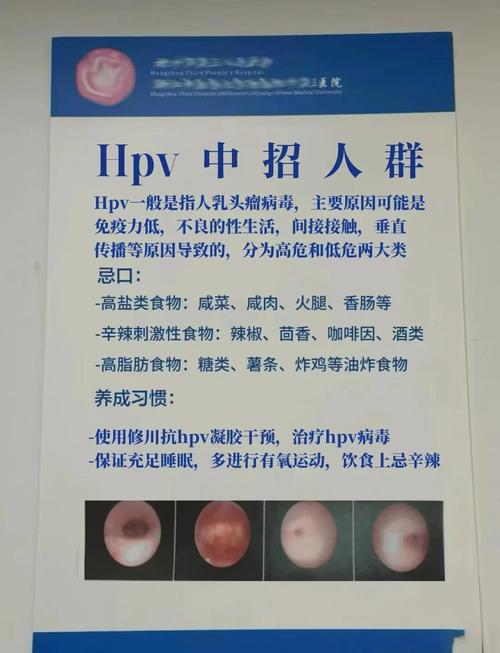 hpv病毒的治疗方法缩略图