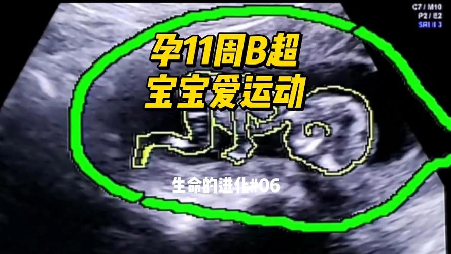 nt在哪预约缩略图