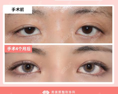 苹果手机视频美颜功能在哪里能找到图标