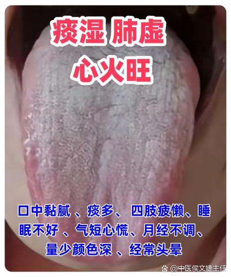 女人气虚是什么原因造成的缩略图