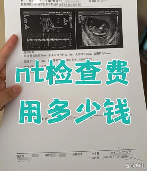nt有必要去大医院做吗游戏截图
