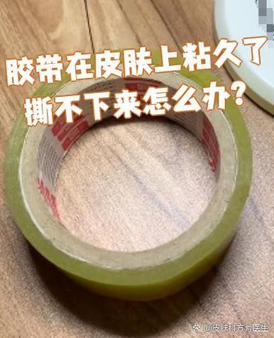 胶布贴久了撕不下来怎么办图标
