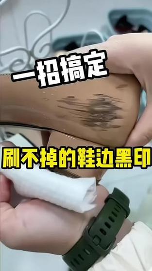 鞋边黑印去除小妙招缩略图