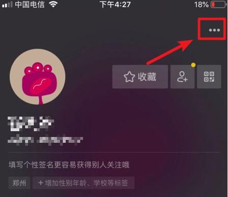 抖音右上角黄点是什么意思缩略图