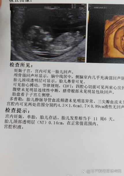 nt检查需要预约吗当天能做吗图标
