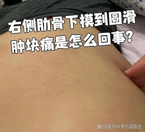 右侧肋骨下有个硬疙瘩按了会疼缩略图