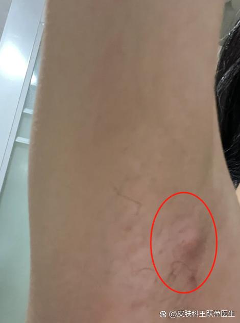 左右胳肢窝里面有个小疙瘩游戏截图