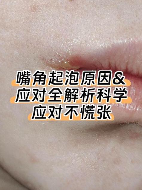烫钻印子去除小妙招缩略图