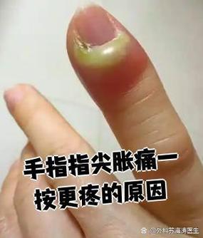 手指尖触摸手机屏幕痛缩略图