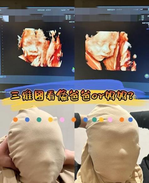 做四维宝宝不给看脸怎么办图标