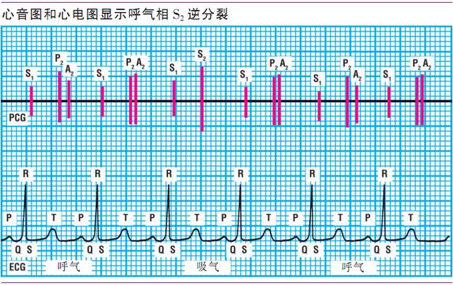 心音s1和s2的区别缩略图