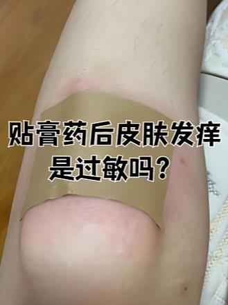 如何把膏药从皮肤上去掉缩略图