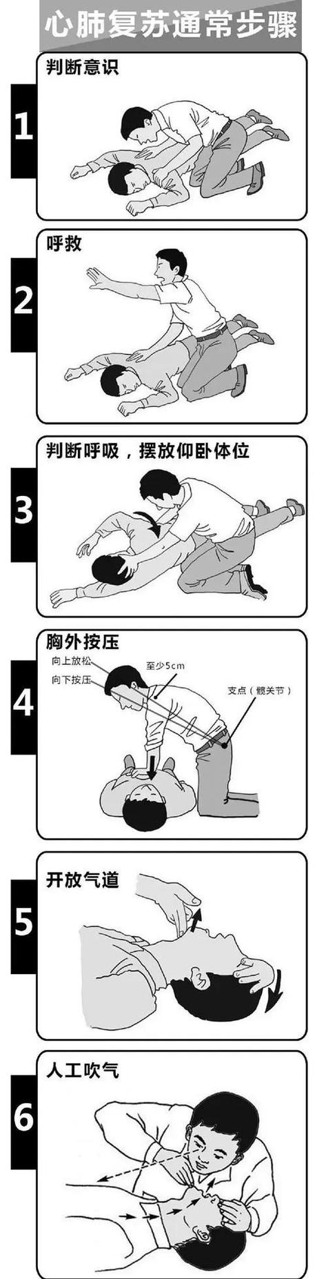 心肺复苏贴吧文