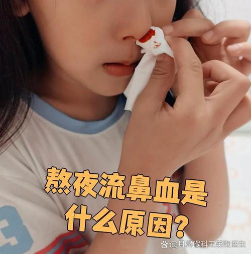 流鼻血感觉累是什么原因缩略图